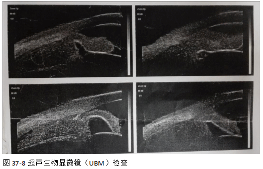 ZY016_196_2.gif